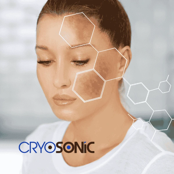 Are you looking for age spot removal treatment? Contact Cryosonic today in Yeovil