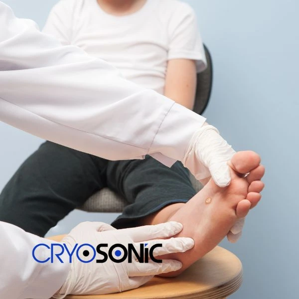 Are you looking for fast effective wart removal Contact us today Yeovil